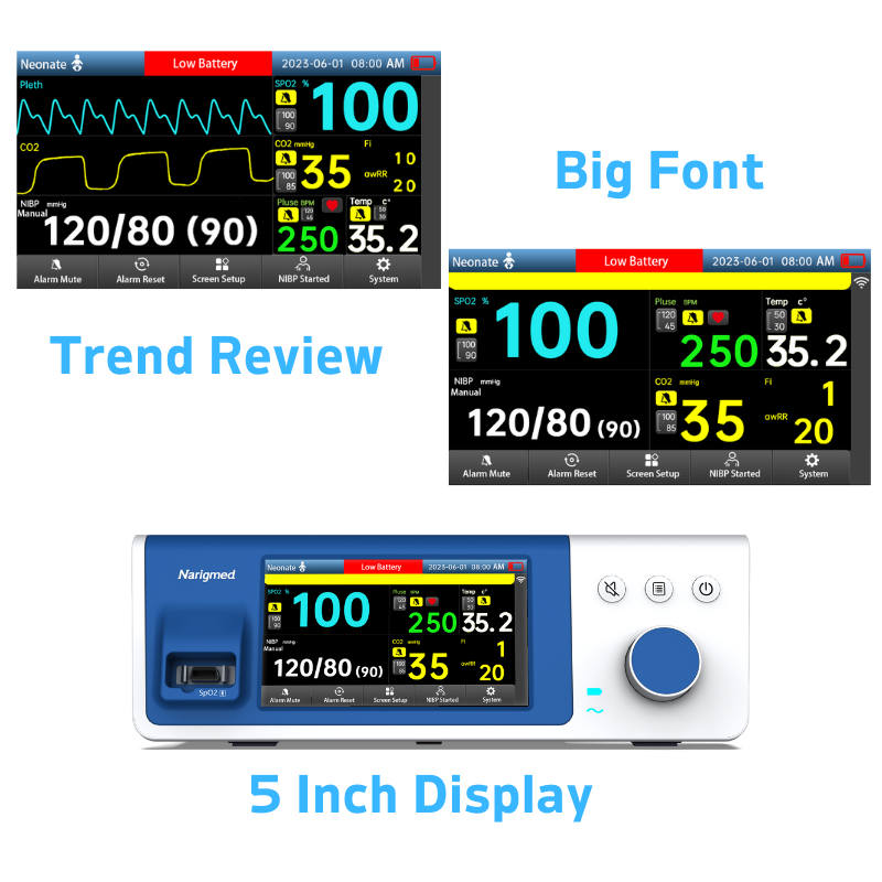 4 BTO-300A bedside monitoring system